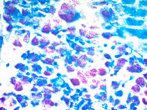 The Fite's Stain Kit (For Leprosy) - 500 mL