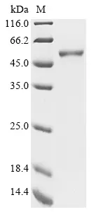[0399-CSB-EP861191HU-100ug] Recombinant Human Forkhead box protein P3 (FOXP3) - 100 ug