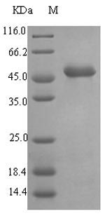 [0399-CSB-EP318584EZX-03] Recombinant Pseudolysin (EC 3.4.24.26, Pseudomonas elastase, Pseudomonas aeruginosa neutral metalloproteinase),  E.coli, 1 mg